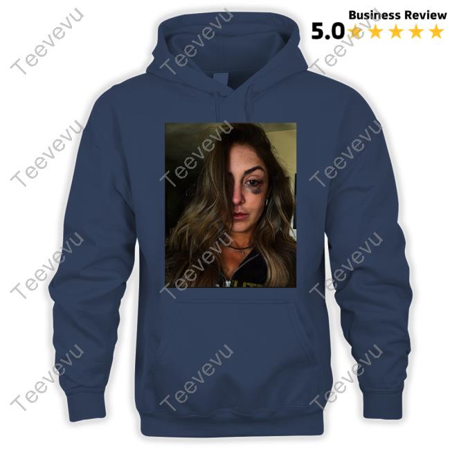 Britt Baker Battle Damage T Shirts